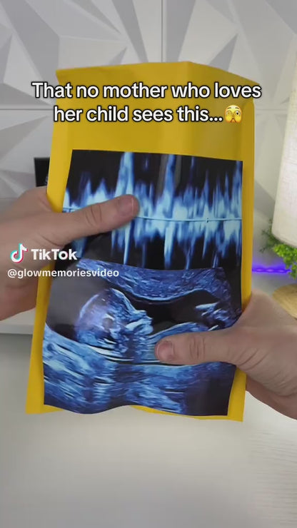 Sphere 3D ultrasound Crystal Ball Video Player, Gift Screen for Couples,Pets, Memories (pre-book)